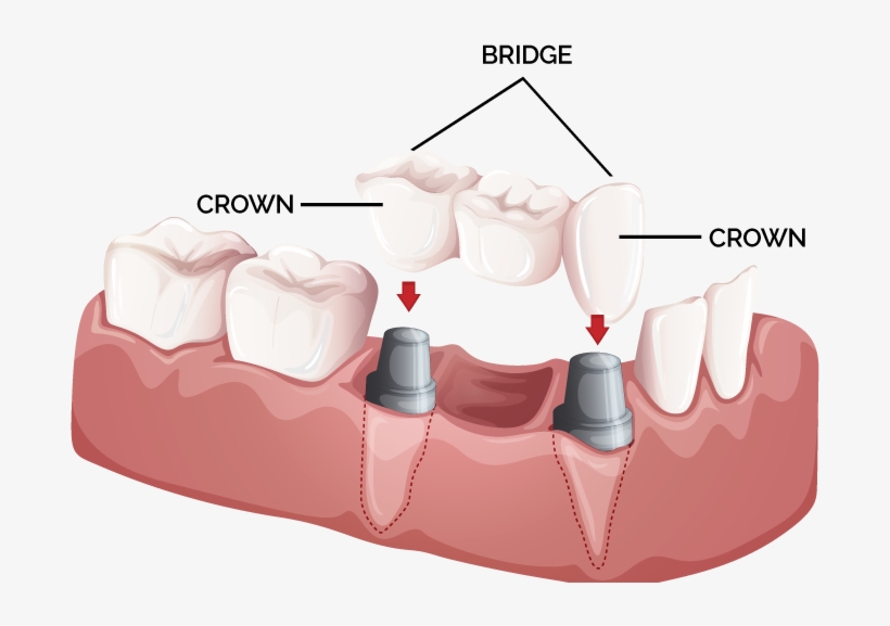 about-image