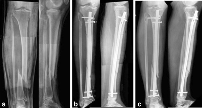 about-image