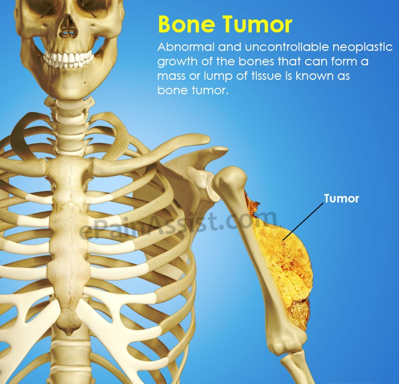 about-image